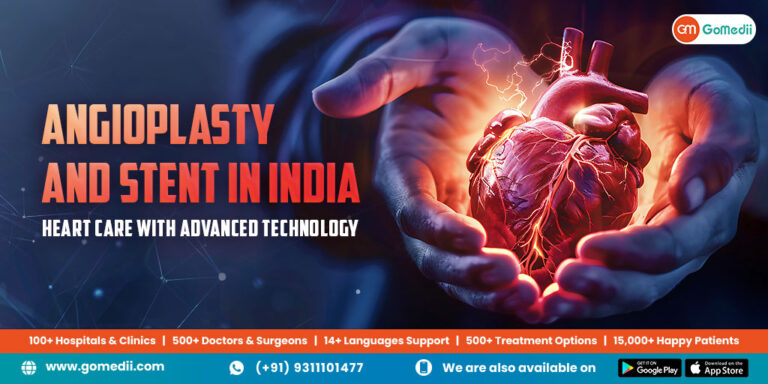 Angioplasty-and-Stent-in-India-Blog_Dec24_v2.jpg